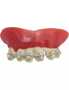 Dentier appareil dentaire