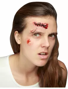 Fausse plaie avec points de suture