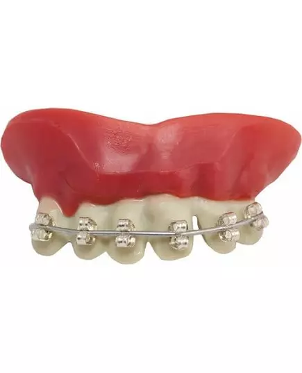 Dentier appareil dentaire